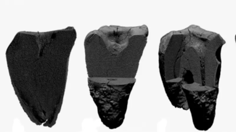 Neanderthals Performed Advanced Dental Procedures 400,000 Years Ago