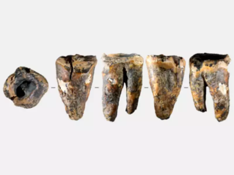 Neanderthals Performed Advanced Dental Surgery 60,000 Years Ago