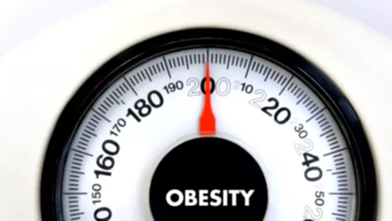 Obesity Rates Surge in Poorer Countries While Rich Nations Plateau, Study Finds
