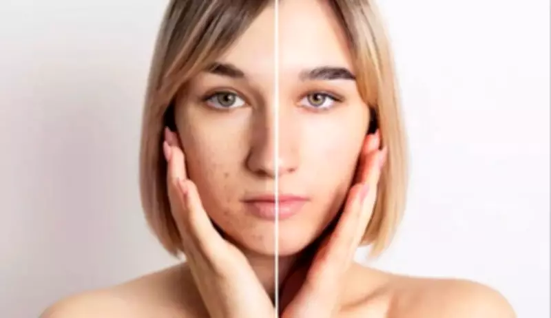 Pigmentation Fix: Expert Tips for Even Skin Tone with Sunscreen and Serums