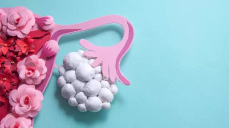 PMOS Misnomer: Why Doctors Prescribe Diabetes Pills for Ovarian Cysts