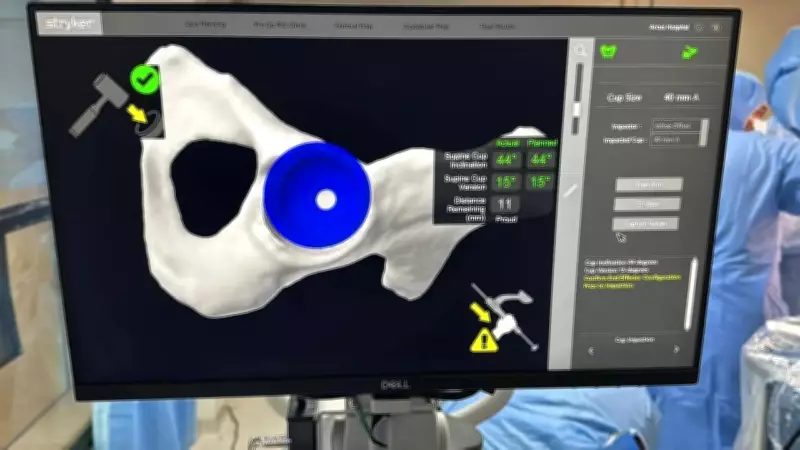 Robotic Hip Surgery Gives New Lease of Life to Morbidly Obese Man