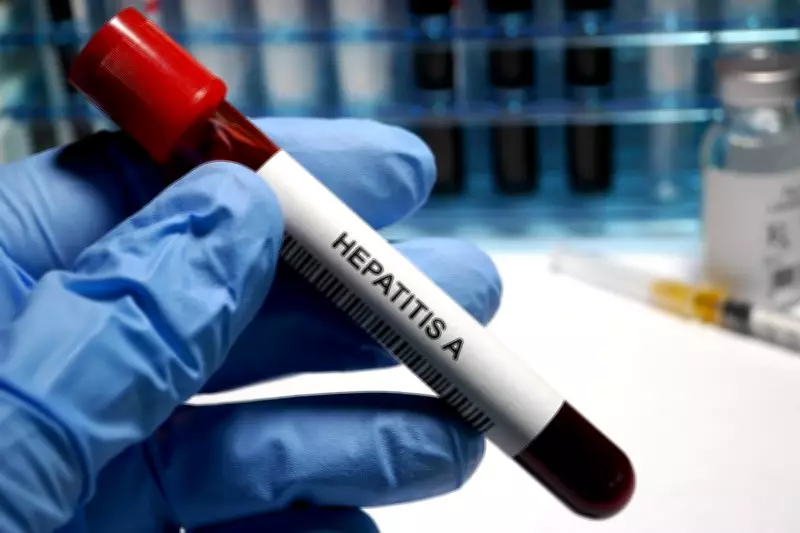 Shimla Reports Surge in Hepatitis A Cases: Symptoms, Causes, and Prevention