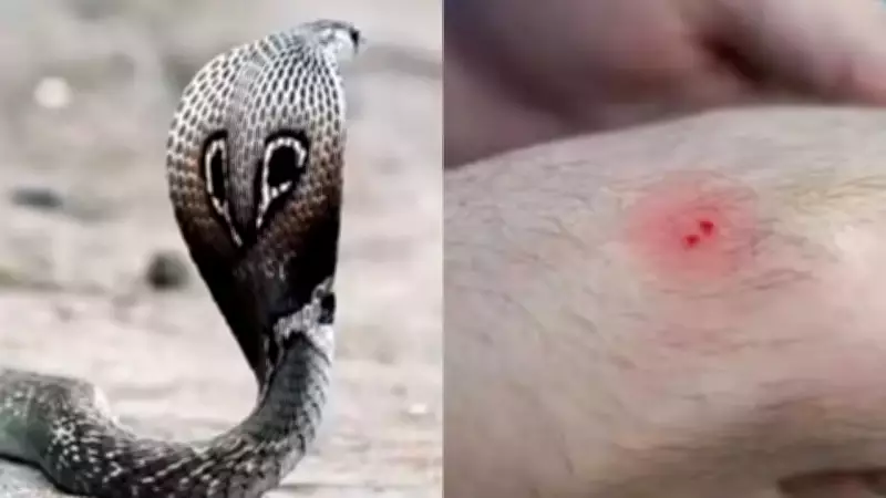 Snakebite Cases Surge Across India as Summer and Monsoon Drive Encounters