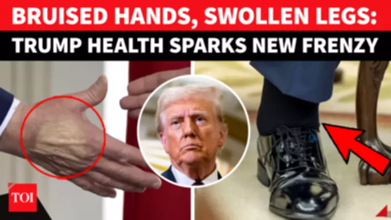Trump Health Report: Bruising and Leg Swelling Addressed in White House Update