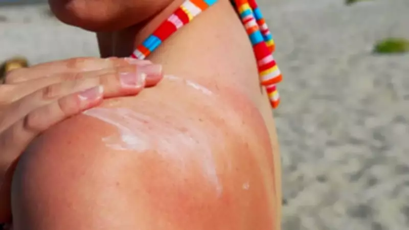 UK Melanoma Cases Hit Record High: Experts Warn of Rising Skin Cancer Risk