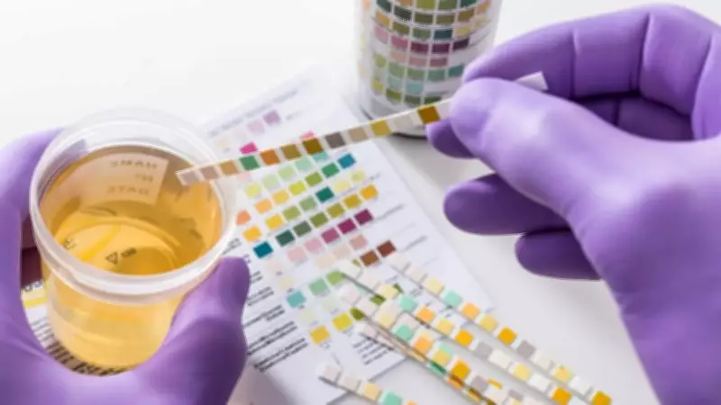 Urine Color: What Your Body Is Trying to Tell You About Your Health