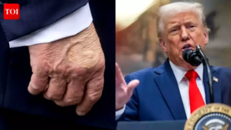 White House Reveals Reason for Trump's Hand Bruises: Handshakes and Aspirin
