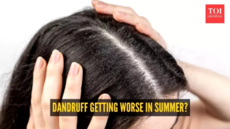 Why Summer Heat and Humidity Can Worsen Dandruff and Scalp Issues