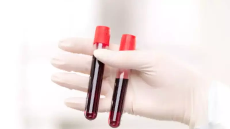 World's Rarest Hybrid B(A) Blood Type Found in Thailand Study