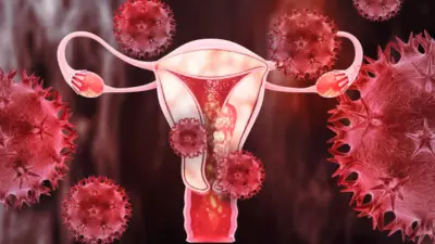 Cervical Cancer Prevention: Expert Insights on Saving Lives Through Vaccination and Screening