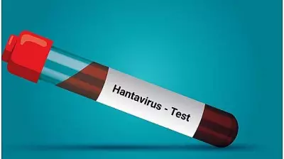 Hantavirus Outbreak: Suspected Cases in Spain's Remote Tristan da Cunha