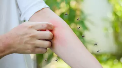 National Dengue Day 2026: Dengue Now a Year-Round Threat, Early Signs Often Missed