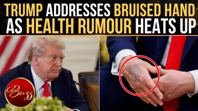 Trump Addresses Bruising, Says Aspirin Use Sign of Caution