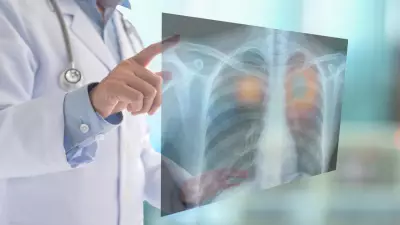 Why Not All Cancers Show Early Warning Signs: Doctors Warn Against Ignoring Mild Symptoms
