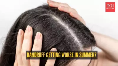 Why Summer Heat and Humidity Can Worsen Dandruff and Scalp Issues
