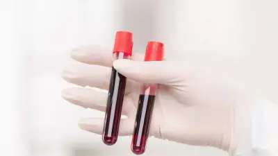 World's Rarest Hybrid B(A) Blood Type Found in Thailand Study