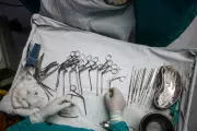 Ahmedabad Doctors Save Woman's Uterus in Rare Placenta Percreta Case
