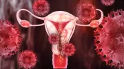 Cervical Cancer Prevention: Expert Insights on Saving Lives Through Vaccination and Screening