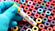 Cervical Cancer: Why Screening Matters for Women's Health
