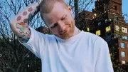 Ed Sheeran Reveals Shingles Diagnosis at Age 35: What You Need to Know