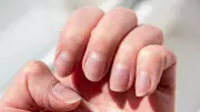 Fingernail Health Signs: What Your Nails Reveal About Your Body