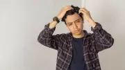 Gen Z Men and Hair Loss: Triggers, Prevention Tips from Dermatologists
