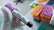 HbA1c Alone Misleading for Diabetes Diagnosis in India, Lancet Study Warns
