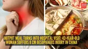 Hotpot Meal Causes 8 cm Oesophageal Ulcer in Chinese Woman, Raises Health Concerns