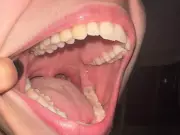 Japanese Scientists Begin Human Trials for Tooth Regrowth Drug TRG-035