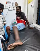 Leopard Attack Near Hampi Injures Youth, Forest Dept on Alert