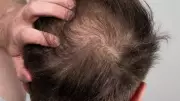 Pakistani LeT Terrorist Got Hair Transplant in Kashmir, Says Life Different From Training