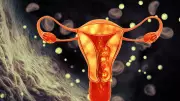 PCOS Renamed to PMOS to Reflect Multi-System Metabolic Impact