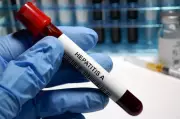 Shimla Reports Surge in Hepatitis A Cases: Symptoms, Causes, and Prevention
