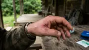 Snake Bite Myths: Why Sucking Venom Is Dangerous and Ineffective