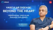 Why Leg Pain Could Signal Peripheral Vascular Disease: Expert Insights