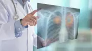 Why Not All Cancers Show Early Warning Signs: Doctors Warn Against Ignoring Mild Symptoms