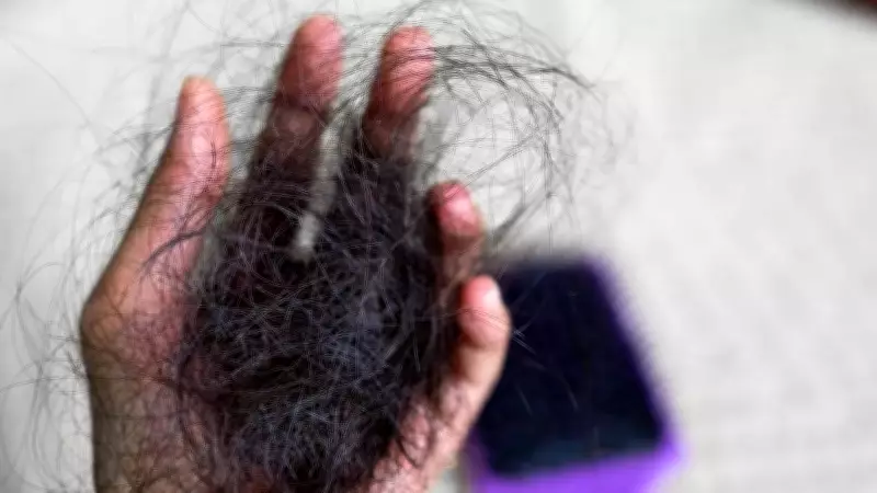 4 Foods to Stop Aggressive Hair Loss and Boost Hair Growth Naturally