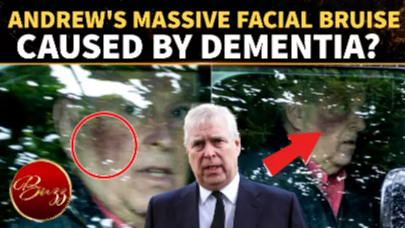 Andrew Windsor's Facial Bruise Sparks Dementia Speculation After Insider Concerns