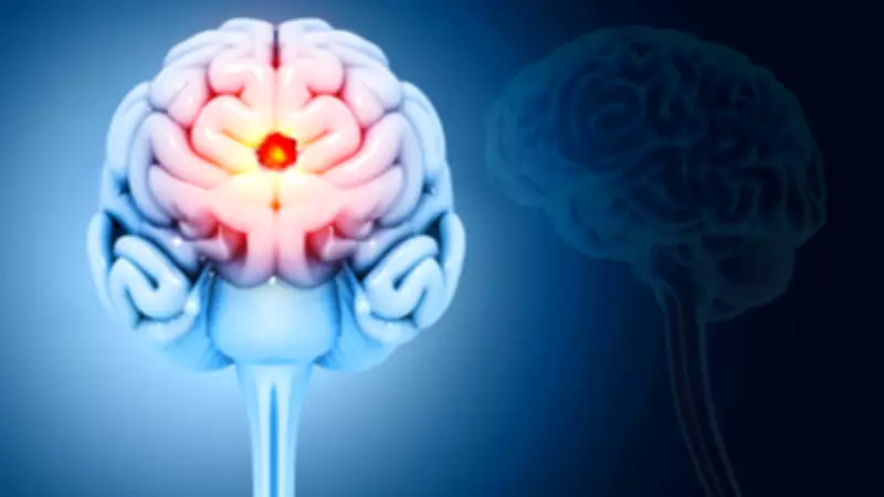 Brain Tumour Symptoms Often Mistaken for Stress or Migraines: Expert