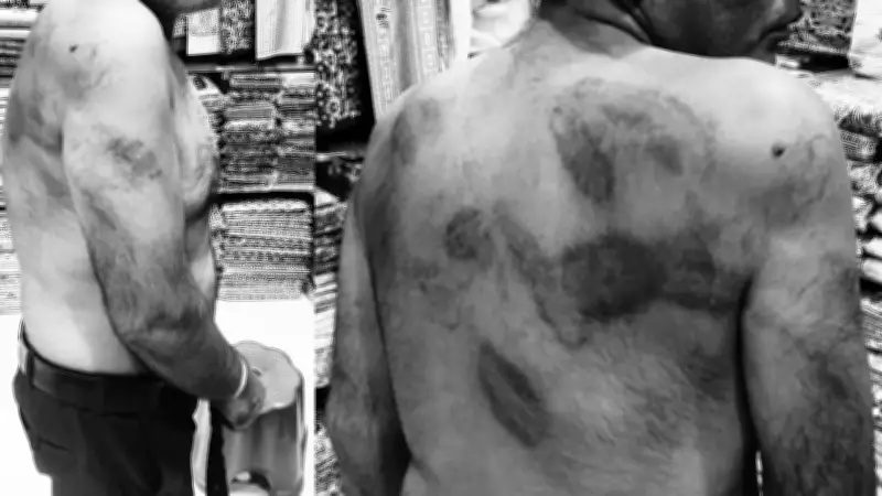 Delhi man alleges torture by police over stolen purse, cop suspended