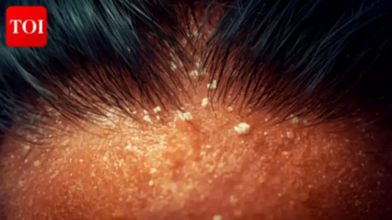 How to Choose the Right Anti-Dandruff Shampoo: Key Ingredients Explained