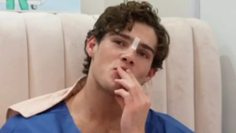 Influencer Streams Nose Surgery Live on Kick, Sparking Debate