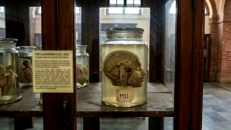 Madras Medical College Museum Holds Murder Victim's Head from 1952 Case