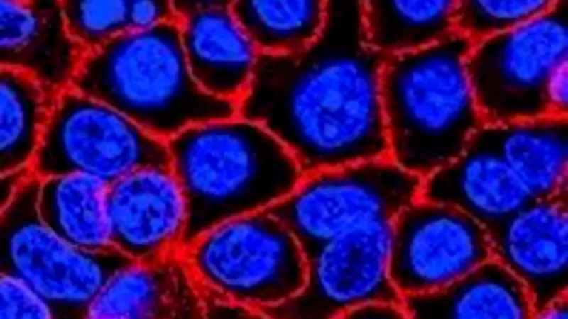 Novel pill daraxonrasib extends survival in advanced pancreatic cancer