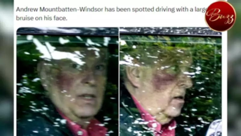 Prince Andrew's Facial Bruise Sparks Questions: Palace Insider Responds