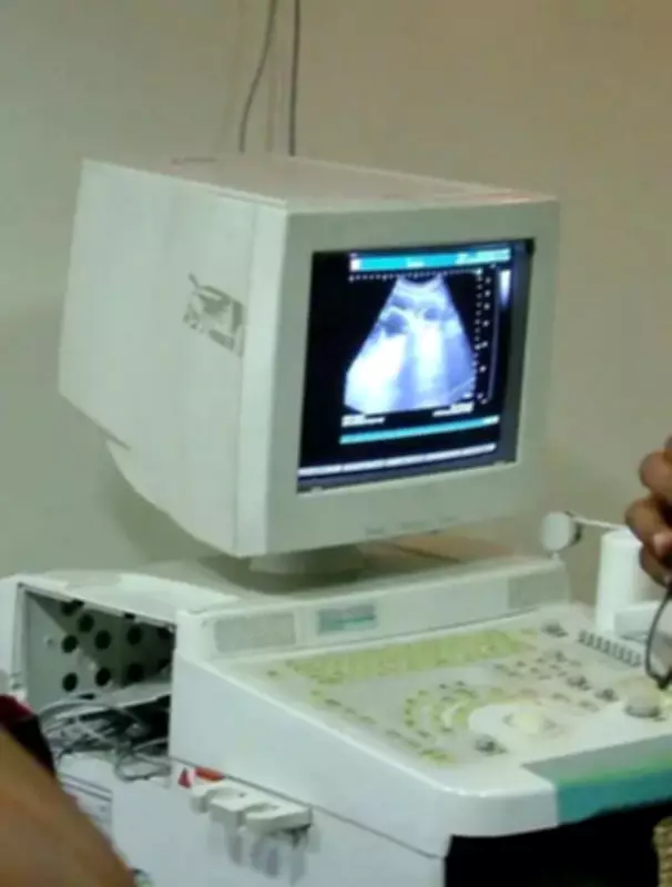Pune Health Dept Inspects 64 Clinics, Arrests 3 in Sex Determination Racket