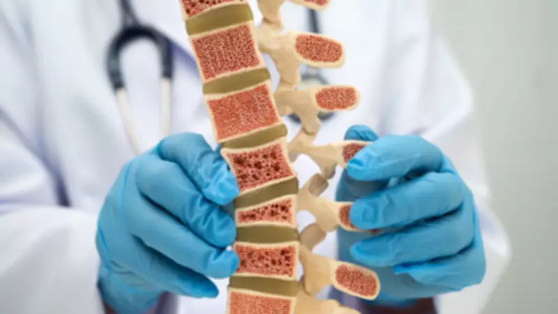 Think Osteoporosis Is Only a Women's Disease? Men Should Be Concerned Too