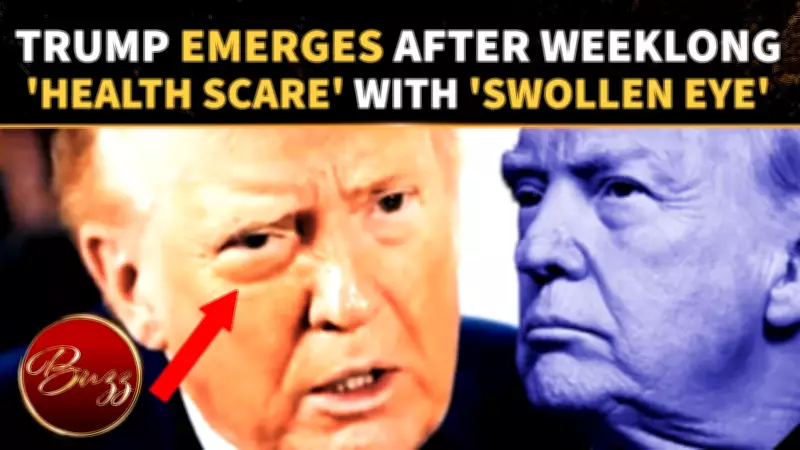 Trump's Swollen Eye Sparks Health Concerns After Week-Long Absence