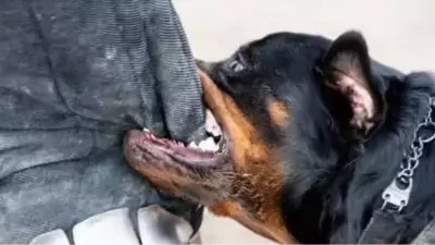 Rottweiler attack victim undergoes surgery; owner blames handler
